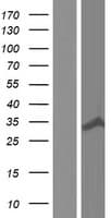 TBC1D7 Protein (Over-Expression Lysate Myc-DDK (Flag))