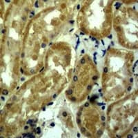 MYC / c-Myc Antibody