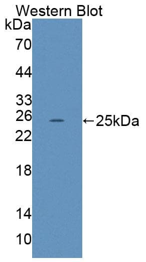 LRP2 / Megalin Antibody (aa4035-4184, Cy3)