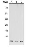 Polyclonal Rabbit anti-Human COX6B2 Antibody (Internal, WB)