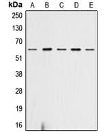 Polyclonal Rabbit anti-Human AKT1 + AKT2 + AKT3 Antibody (phospho-Ser473, IHC, WB)