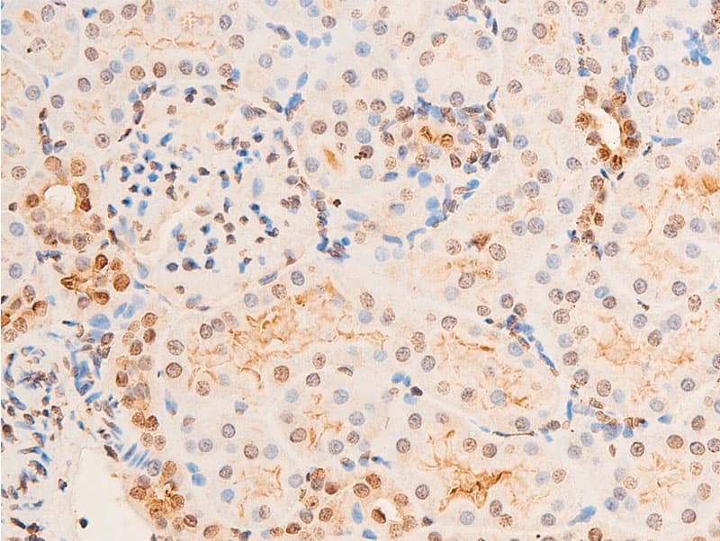 Polyclonal Rabbit anti-Human CHEK2 / CHK2 Antibody (phospho-Thr383, IHC, IF, WB)