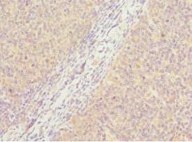 PCM1 Antibody