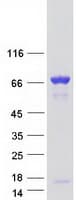 Human CORO1B Protein (Recombinant Myc-DDK (Flag))