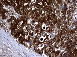 NME1 / NM23 Antibody (clone OTI1C11)