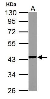 Polyclonal Rabbit anti-Human NDUFA10 Antibody (aa115-355, IHC, WB)