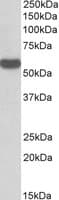 IHC-plus™ RTCB / C22orf28 Antibody (aa201-214)