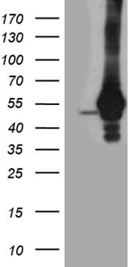 Monoclonal Mouse anti-Human TDP2 / TTRAP Antibody (clone OTI3G10, WB)