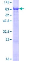 Human EVC / DWF-1 Protein (Recombinant GST)