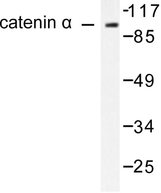 Alpha 1+2 Catenin Antibody (Pro940)