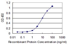 Monoclonal Mouse anti-Human NEB / Nebulin Antibody (clone 1F4, WB)