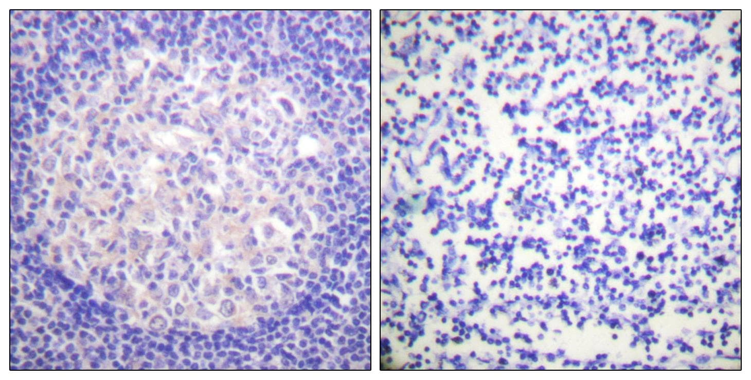 NFKBIA / IKB Alpha / IKBA Antibody (Ab-305)