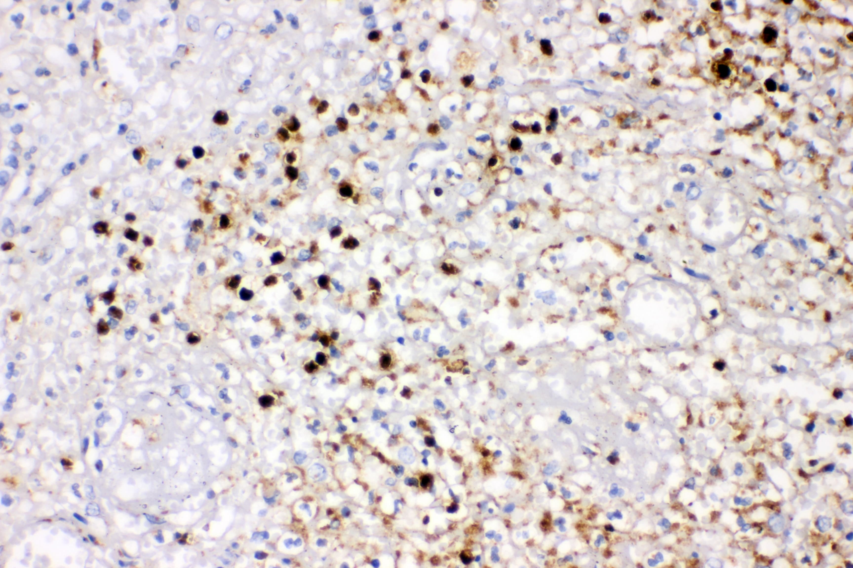 Polyclonal Rabbit anti-Human IL8 / Interleukin 8 Antibody (aa23-99, WB)