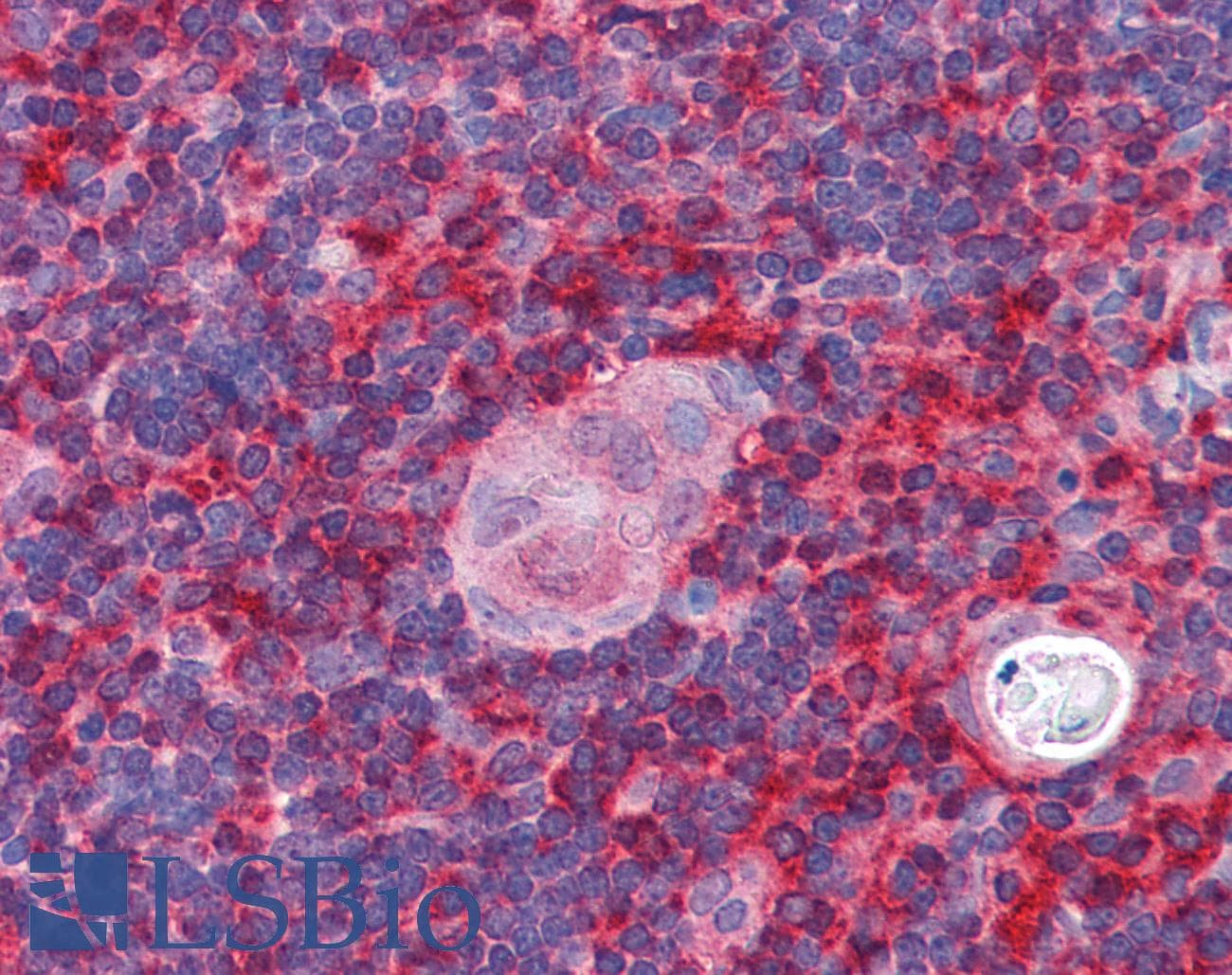 IHC-plus™ ARPC1B / p41-ARC / ARP2 Antibody (aa2-14)