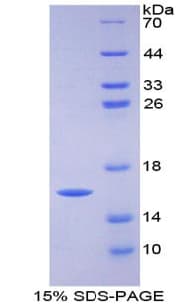 Human FABP3 / H-FABP Protein (Recombinant His)
