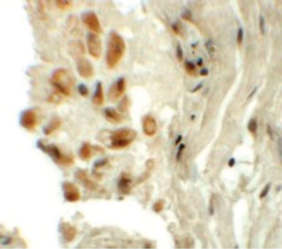 Polyclonal Rabbit anti-Human TYW1 Antibody (IHC, WB)