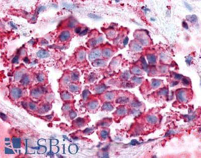 PathPlus™ Polyclonal Rabbit anti-Human P2RY6 / P2Y6 Antibody (Cytoplasmic Domain, IHC)