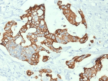 KRT20 / CK20 / Cytokeratin 20 Antibody (clone KRT20/1992, Azide-free, BSA-free)