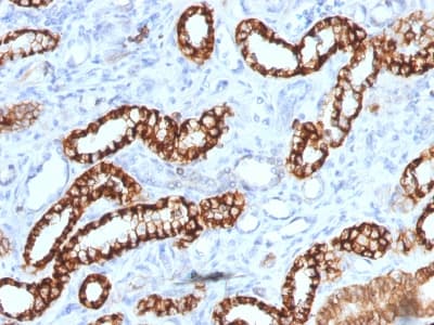 Recombinant Monoclonal Mouse anti-Human CDH16 / Cadherin 16 Antibody (clone rCDH16/1071, Azide-free,Carrier-free, IHC, WB)
