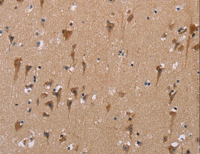 Polyclonal Rabbit anti-Human POMT1 Antibody (IHC, WB)