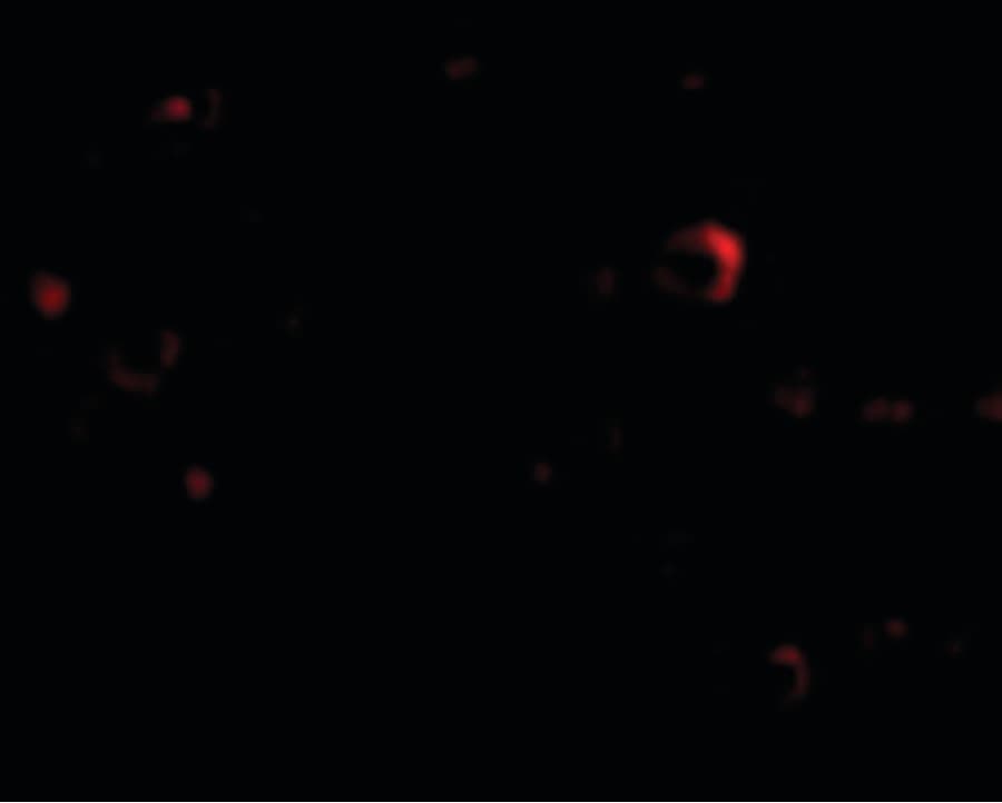 IHC-plus™ TMC8 / EVER2 Antibody