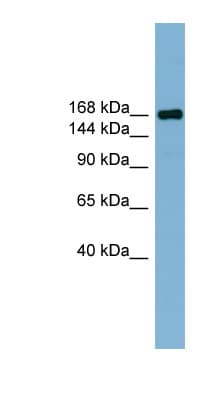 Polyclonal Rabbit anti-Human PARD3 Antibody (C-Terminus, WB)