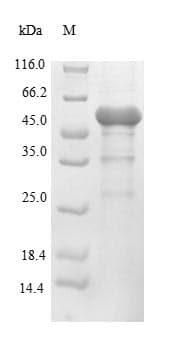 Pseudomonas aeruginosa lpxC / asmB / envA Protein (Recombinant 10His-SUMO, N-terminus + Myc, C-terminus)