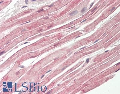 Polyclonal Rabbit anti-Human Dysferlin Antibody (aa1296-1345, IHC, WB)