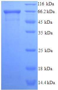 Human EIF5 Protein (Recombinant His-SUMO)