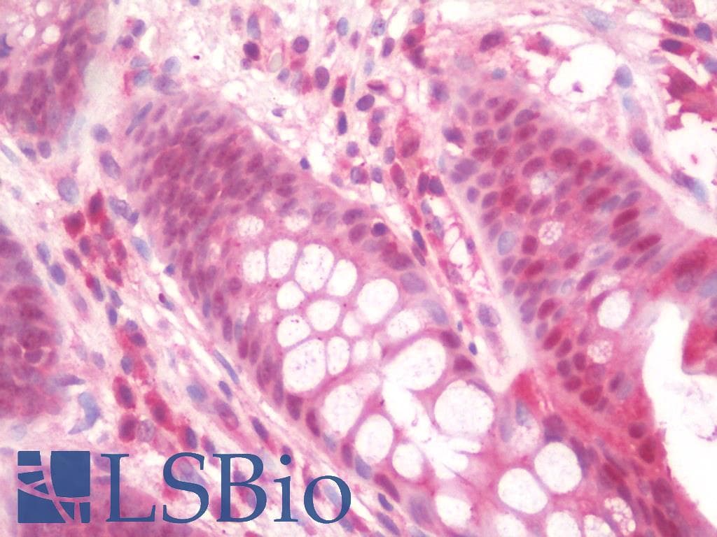 IHC-plus™ IL36B Antibody