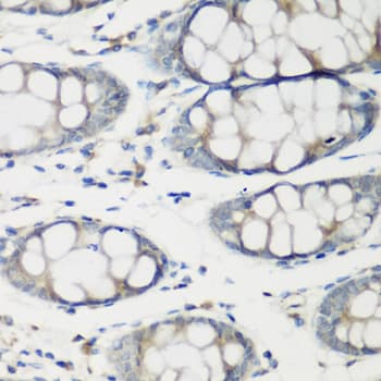 Polyclonal Rabbit anti-Human TNNC2 Antibody (IHC, WB)