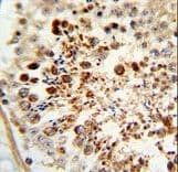 Polyclonal Rabbit anti-Human COX6A1 Antibody (aa50-78, IHC, WB)