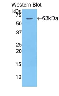 TERT / Telomerase Antibody (aa642-974, FITC)