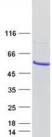 Human IP6K3 Protein (Recombinant Myc-DDK (Flag))