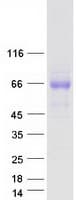Human TMEM181 Protein (Recombinant Myc-DDK (Flag))