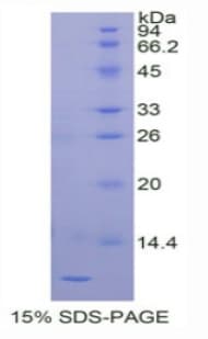 Human PLAC9 Protein (Recombinant His-T7)