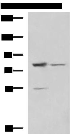 SORBS2 / ARGBP2 Antibody
