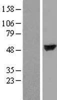 Human TTC38 Protein (Over-Expression Lysate Myc-DDK (Flag))