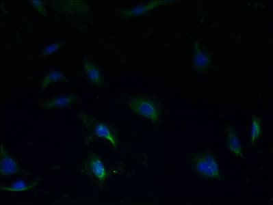 S1PR1 / EDG1 / S1P1 Antibody