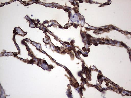 KRT19 / CK19 / Cytokeratin 19 Antibody (aa240-390, clone OTI1C11)