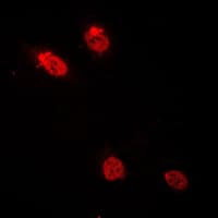 CEBPD + CEBPE Antibody (C-Terminus)