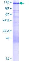Human PKN1 Protein (Recombinant GST)