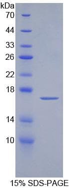 Human AZGP1 / ZAG Protein (Recombinant His)
