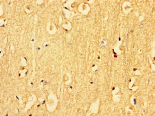 KLK6 / Kallikrein 6 Antibody