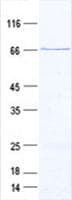 Human DACT3 Protein (Recombinant GST, N-terminus + His, C-terminus)