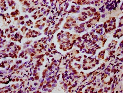 Polyclonal Rabbit anti-Human HIST1H3A Antibody (IHC, WB)