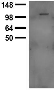 Monoclonal Mouse anti-Human TRPC5 Antibody (clone S67-15, aa827-845, IHC, IF, WB)
