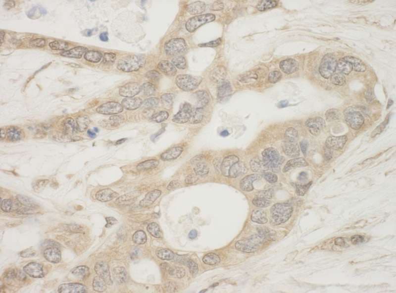 BAD Antibody (aa1-50)