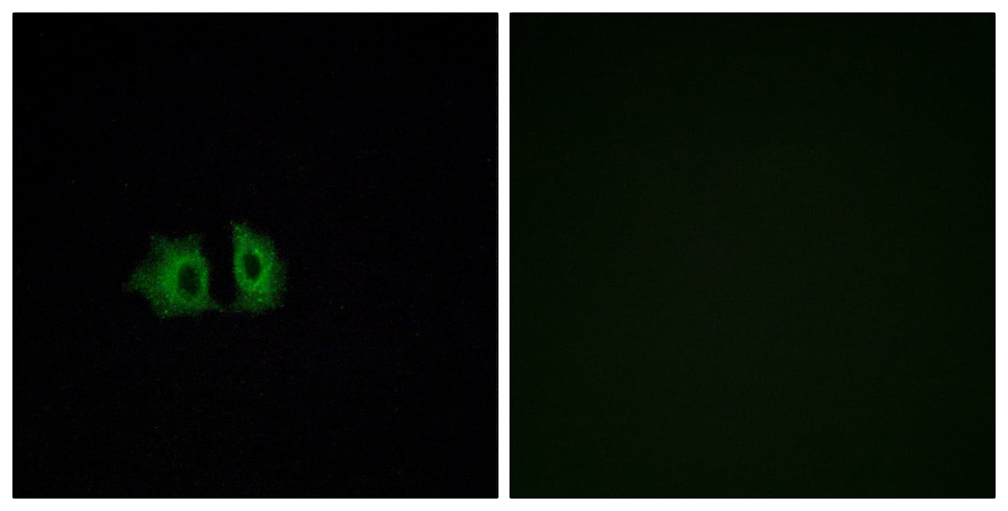 IHC-plus™ Polyclonal Rabbit anti-Human FZD5 / Frizzled 5 Antibody (aa461-510, IHC, IF, WB)