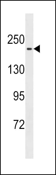 Polyclonal Rabbit anti-Mouse MAST1 Antibody (aa1438-1464, WB)